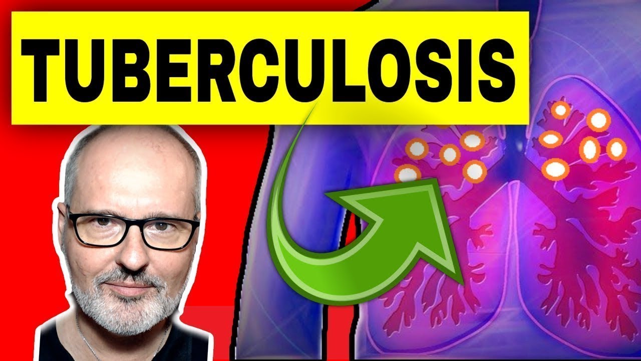 WHAT IS TUBERCULOSIS: EVERYTHING YOU NEED TO KNOW