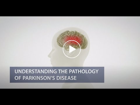 Understanding the Pathology of Parkinson’s Disease