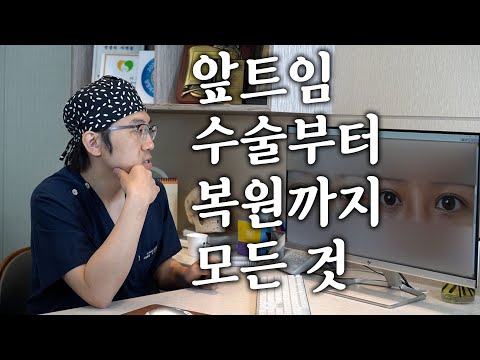开眼角 02