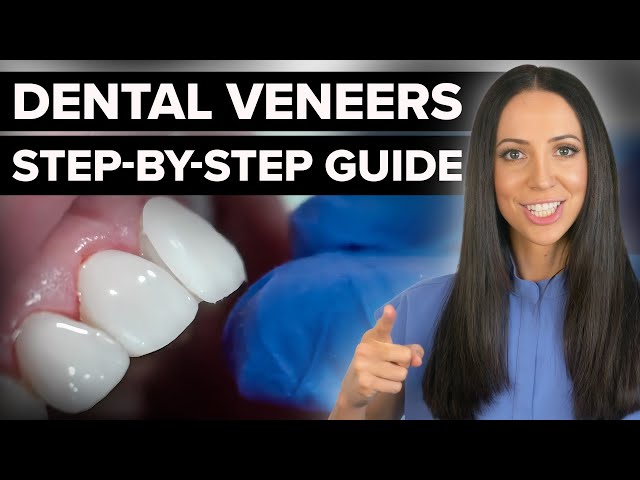 Dental Veneers Step by Step