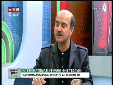 KAS ROMATİZMASI, FİBROMİYALJİ VE KURU İĞNE BEA-TV, DR. SERDAR SARAÇ