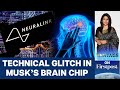 Elon Musk’s Neuralink Had a Brain Implant Setback. Is it all bad? | Vantage with Palki Sharma