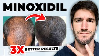 미녹시딜 사용을 중단하기 전에 사람들이 알았으면 하는 10가지