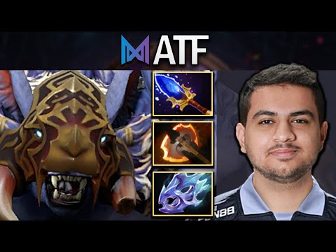 Ursa Dota 2 Gameplay Nigma.ATF with 28 Kills and Moon Shard
