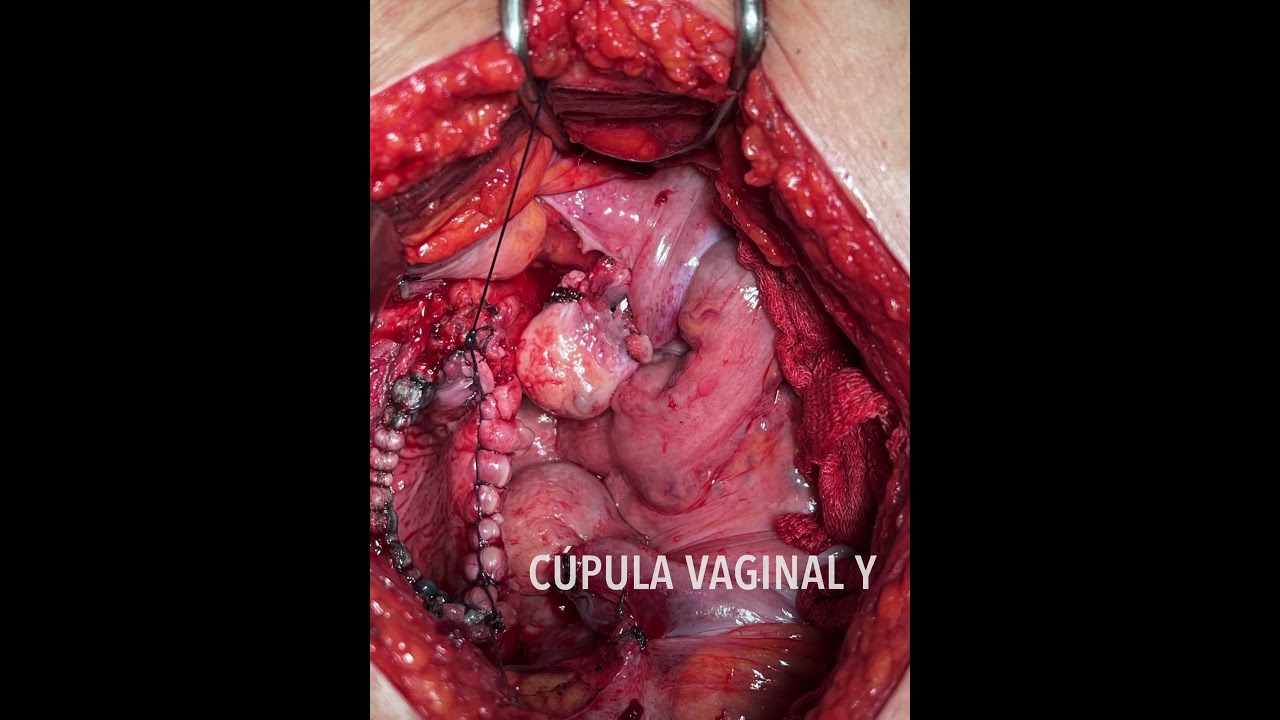 Ángel Millán Juárez-91