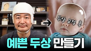 우리 아기 예쁜 두상 만들기! 고민이신 분들 늦기 전에 알아보세요!