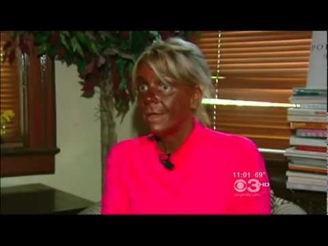 Patricia Krentcil Tanning Trouble