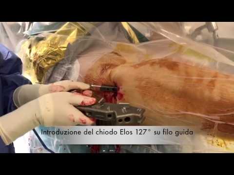 Massaggio in regime di osteocondrosi lombare Con dolore dietro lorecchio sulla parte posteriore della testa al collo