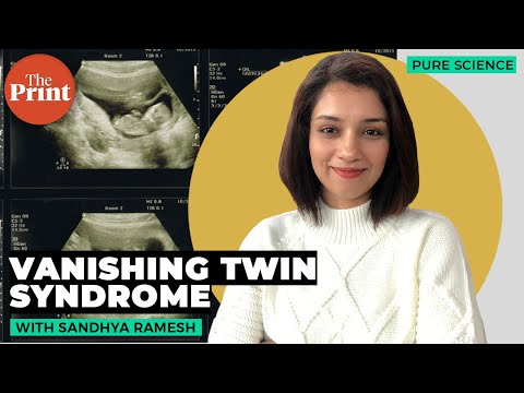 Pregnant With Twins and Miscarrying One: Explained Simply