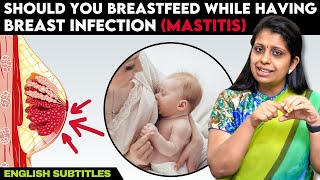 Should You Breastfeed While Having Breast Infection (Mastitis) பாலூட்டும் பெண்கள் கவனிக்க வேண்டியவை!