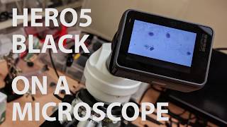 GoPro Hero5 on a Microscope
