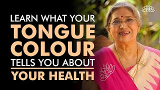 Learn What The Colour Of Tongue Reveals About The State Of Your Health | Dr. Hansaji Yogendra