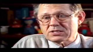 Conjoined Twins Documentary