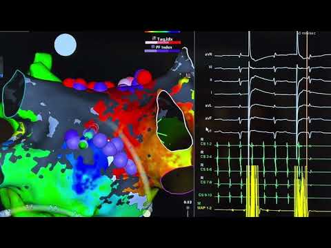 Giuseppe Augello-12