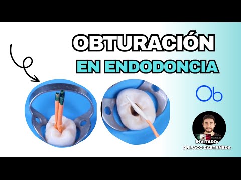 Obturación en Endodoncia