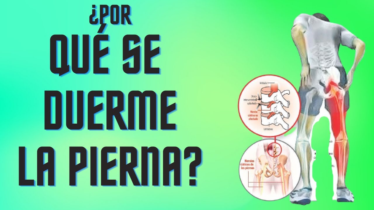 Por qué se me duerme la pierna