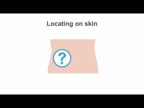 Mastering Femoral Artery Access in PCI