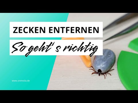 Zecken entfernen: Die besten Tipps und Methoden