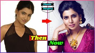 SHOCKING Plastic Surgery of South Indian Actresses BEFORE & AFTER | Samantha Akkineni, Rashmika video
