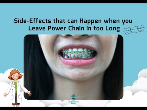 What can Happen when you Leave Power Chains on too Long