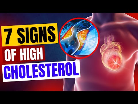 7 Warning Signs of High Cholesterol You Shouldn't Ignore #HeartHealth  #HighCholesterol