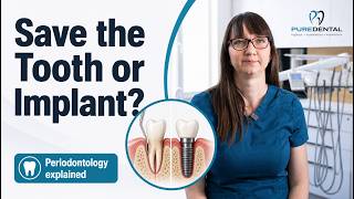Save the Tooth or Choose an Implant?