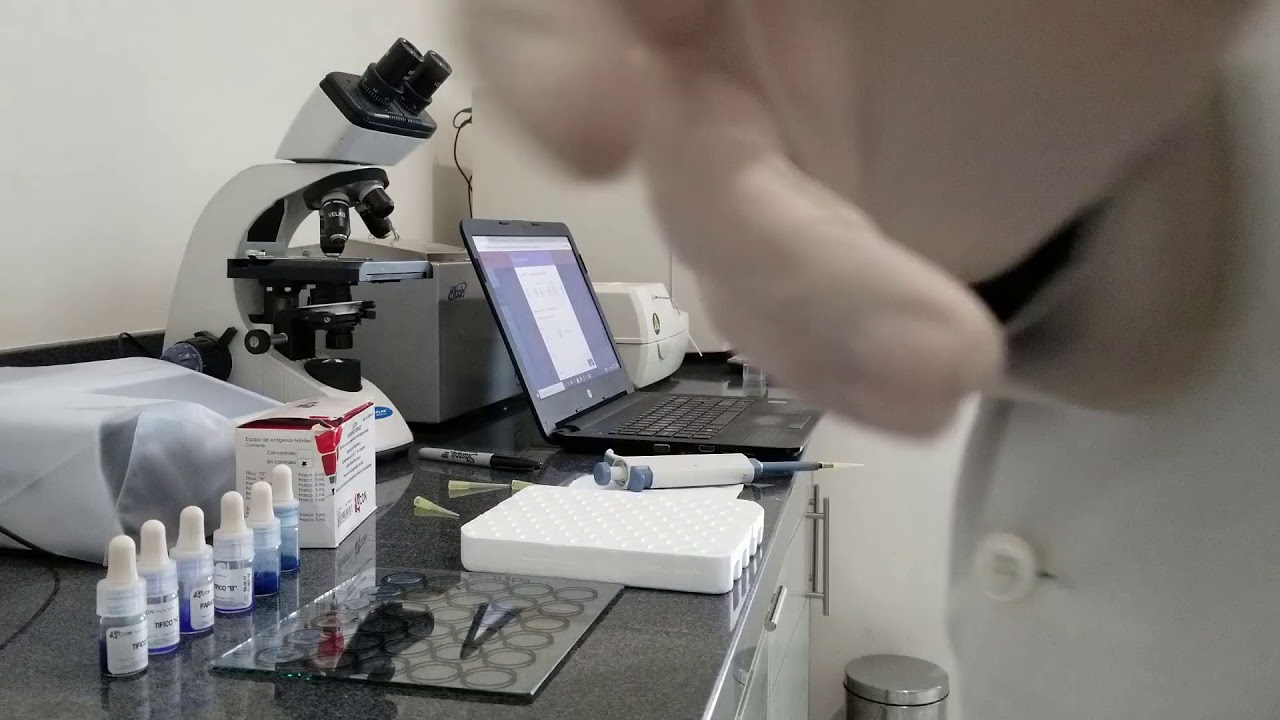 Como hacer las REACCIONES FEBRILES en el laboratorio facil y rapido, y para que son importantes