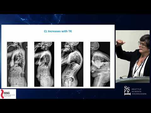 Cervical Alignment & Associated Outcomes - Virginie LaFage, PhD