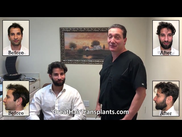 Dr. Brett Bolton Patient Lionel MaxHarvest&trade; Procedure


