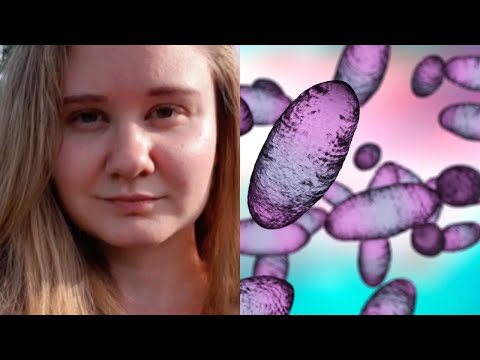 Russia downplays plague fears after lab researcher's death