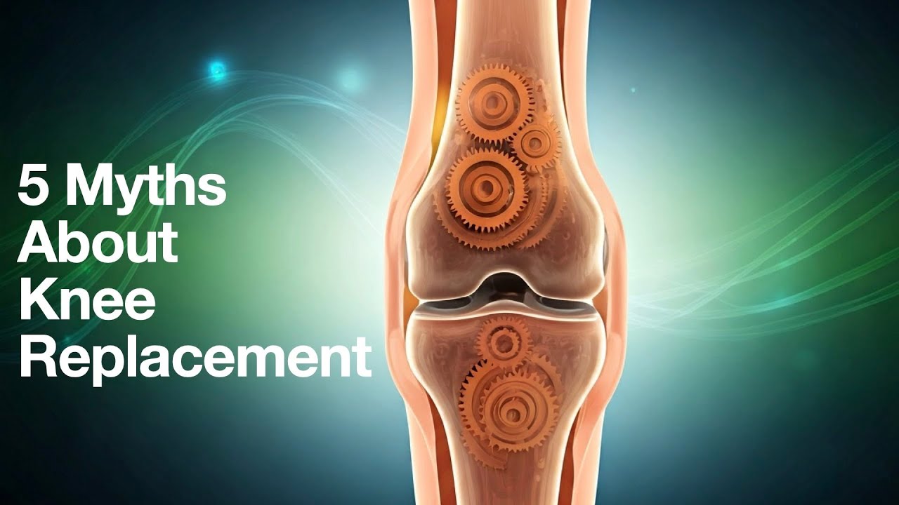 5 Knee Replacement Myths