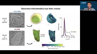 LRD Seminar | Lipids and organelle and mitochondrial biology