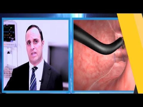 تكميم المعدة بدون جراحة