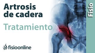 Artrosis de cadera - Tratamiento con ejercicios, estiramientos y masajes