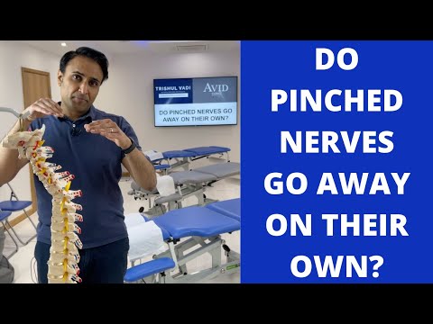Do Pinched Nerves Go Away On Their Own?