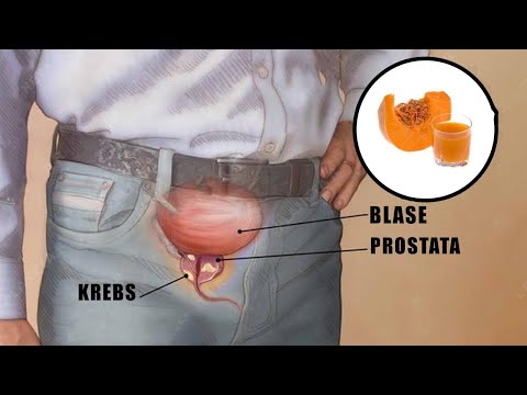 Novir Prostatitis Vélemények