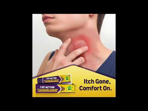 Top Action Finished Product Itch Relief Cream, For Personal, Packaging Size: 25 Gms Tube