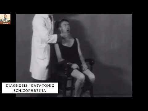 A real video of Catatonic schizophrenia