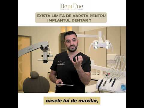 Care este limita de vârstă pentru implantul dentar?
