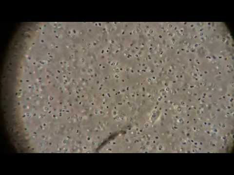 Haloferax Mediterranei 100x magnification.