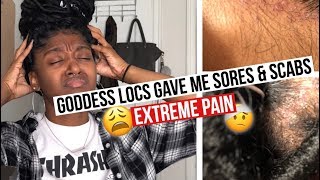 Getting Faux Locs (Pain, Sores &amp; Scabs) | HeyLayah