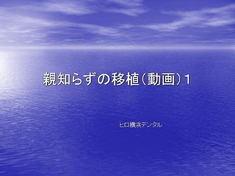 歯学科 ヒロ横浜デンタル　歯の根が割れて抜くことになった箇所に自分の親知らずを移植（No10)