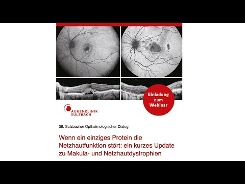 SOD Seminar: Wenn ein einziges Protein die Netzhautfunktion stört - Ein Update zu Makuladystrophien