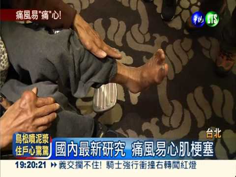 痛風要小"心"! 心肌梗塞率增23%