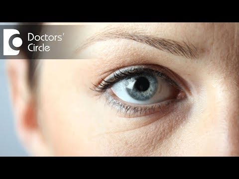 What causes dark spots in the white part of eyes? - Dr. Elankumaran P
