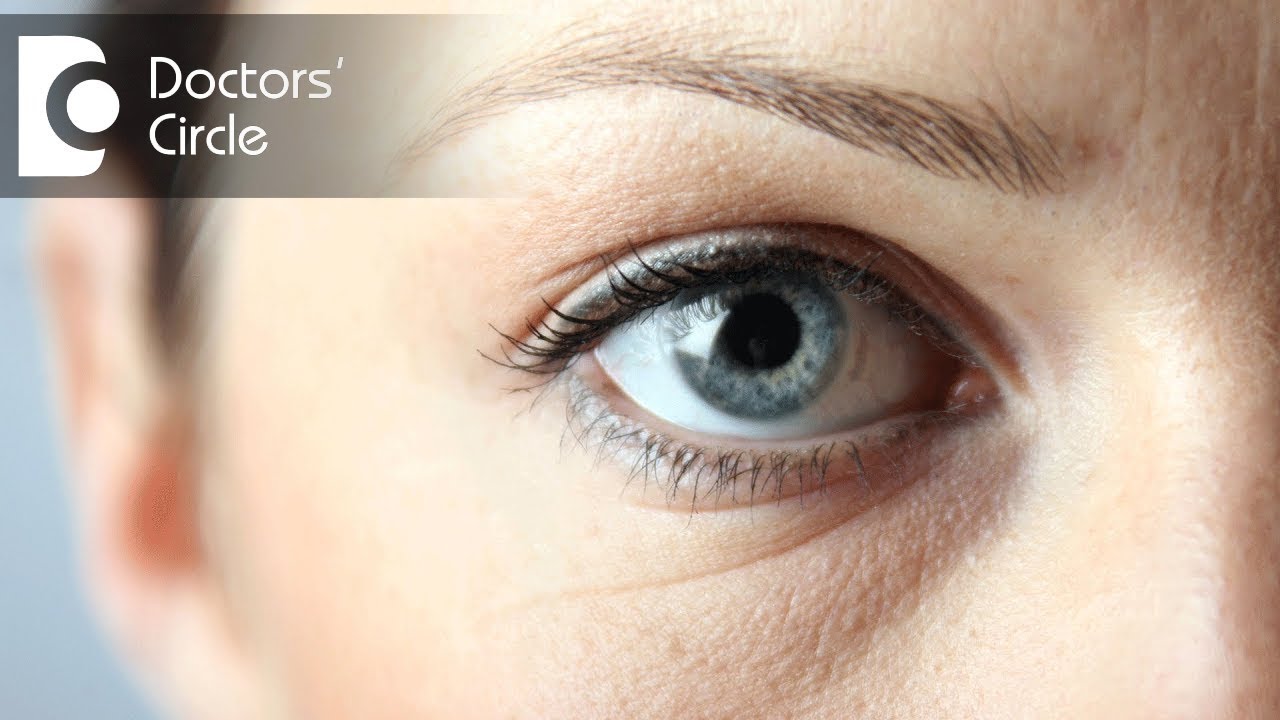 What is white part of eye?