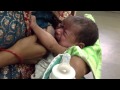 Bottle Feeding Leads To Breastfeeding Failure By Nipple Confusion
