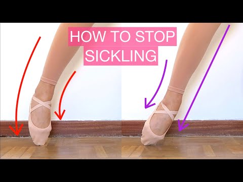 Sickled Feet In Dancing