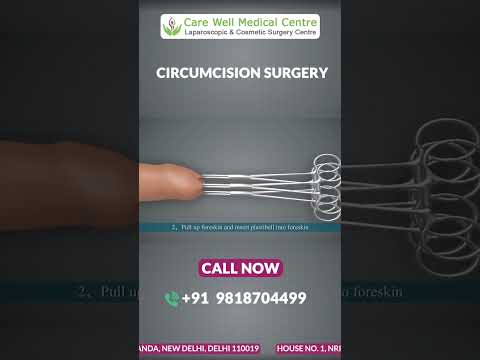 ZSR Circumcision Surgery in Delhi: A Step-by-Step Animated Guide | Circumcision Surgery Cost #shorts