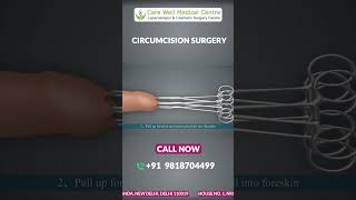 ZSR Circumcision Surgery: A Step-by-Step Animated Guide | Care Well Medical Centre #shorts